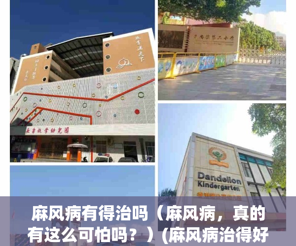 麻风病有得治吗（麻风病，真的有这么可怕吗？）(麻风病治得好吗)